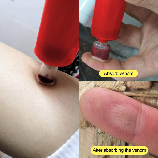 Snake Bite Kit, Bee Sting Kit, Emergency First Aid Supplies, Venom Extractor Suction Pump, Bite and Sting First Aid for Hiking, Backpacking and Camping